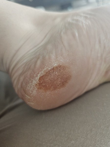 Can anyone help? Picture of foot