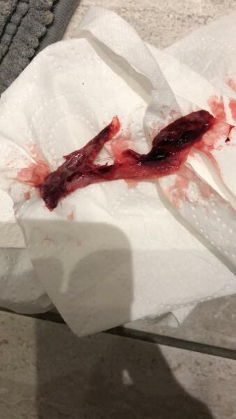 Is this my baby? *Warning graphic pic! *