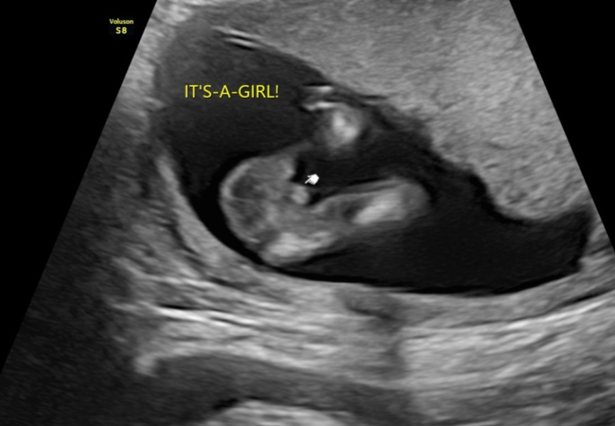 Due April 2025 ✨