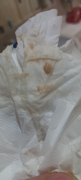 10 weeks pregnant with this discharge this morning