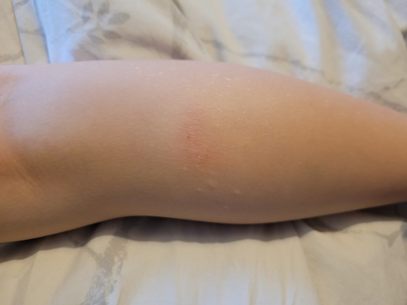 Any idea what this might be on DS' leg?