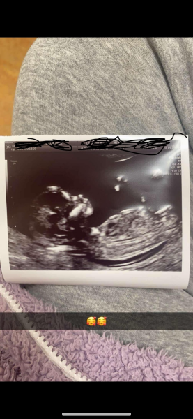 Boy or Girl??🩵🩷 just for fun