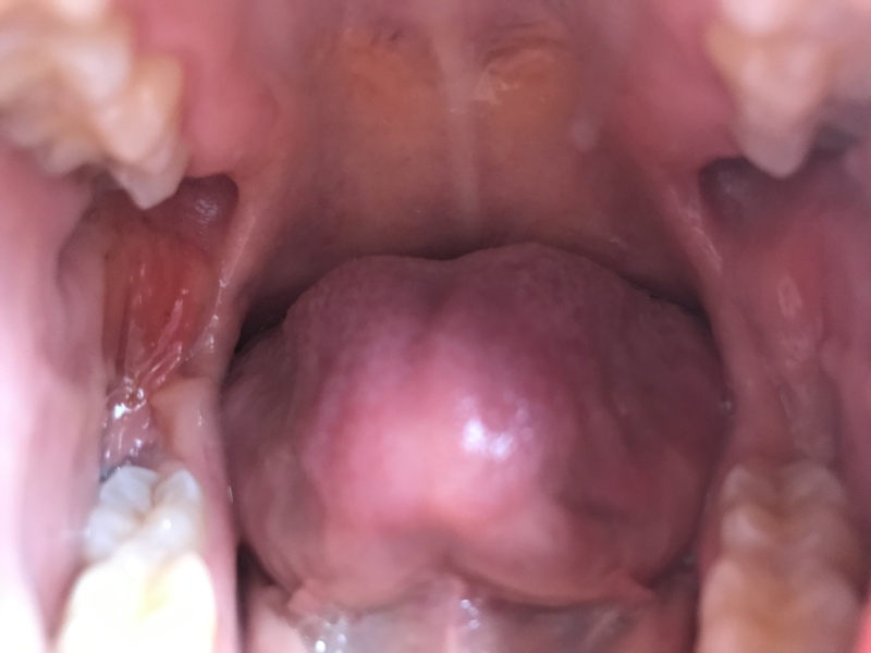 Any ideas why one side of of my gums is more red than the other?