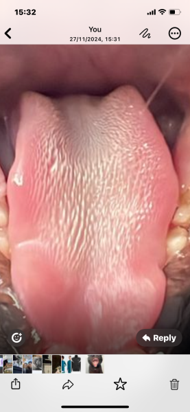 White ulcer on cat’s tongue