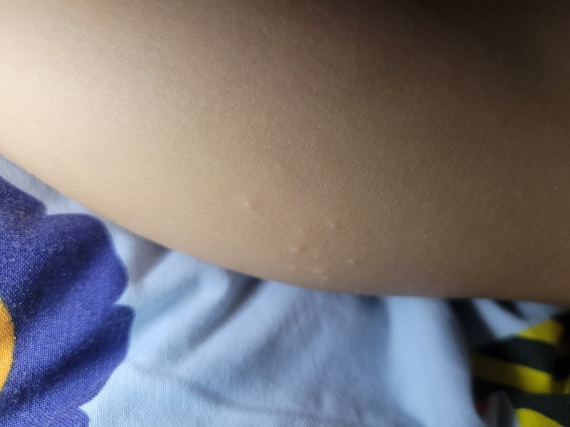 Any idea what this is on my finger?