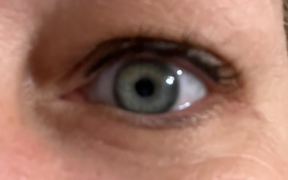 what color are these eyes?