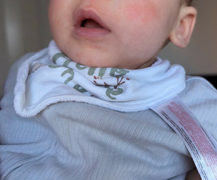 Are my babies lips blue, should I be worried?