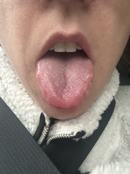 Tongue - side of both sides looks bumpy