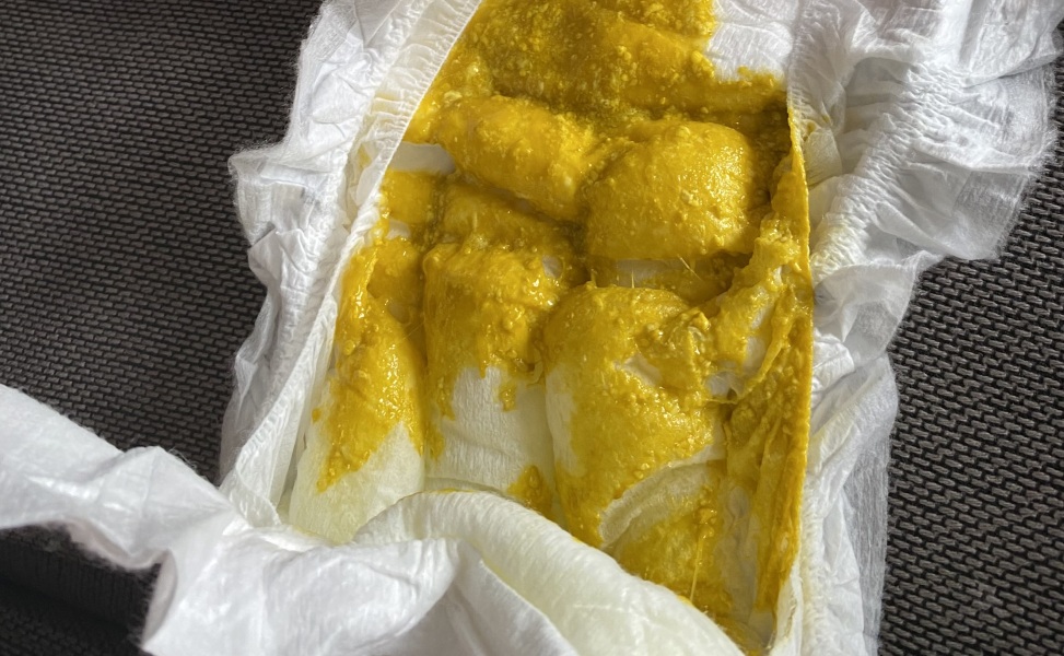 3 month old diarrhoea- Advice please