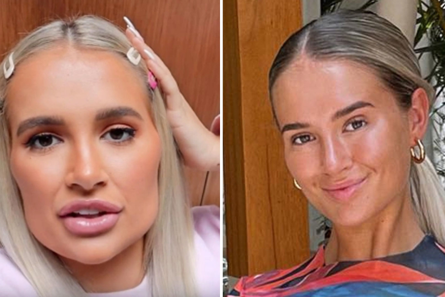 To think in ten years all these huge veneers and huge lips will be seriously dated?