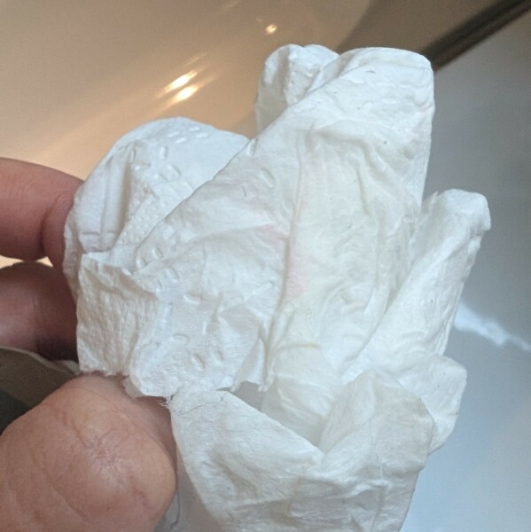 Is this implantation bleeding???