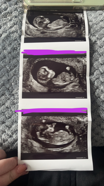 A little bit of fun "boy or girl"