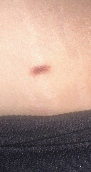 Mole