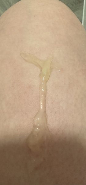 *WARNING TMI* Eggwhite Discharge