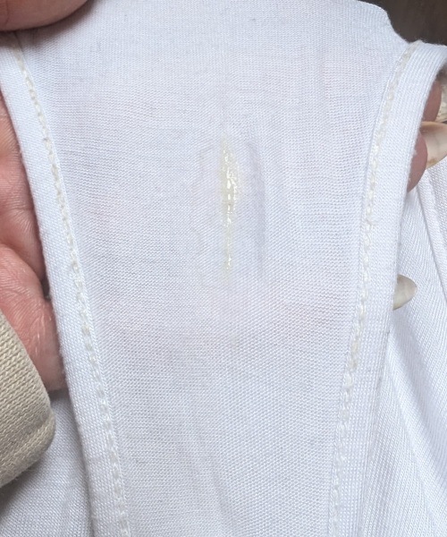 Tmi photo! Yellow discharge 11dpo