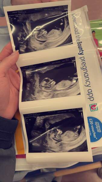 Boy or girl?