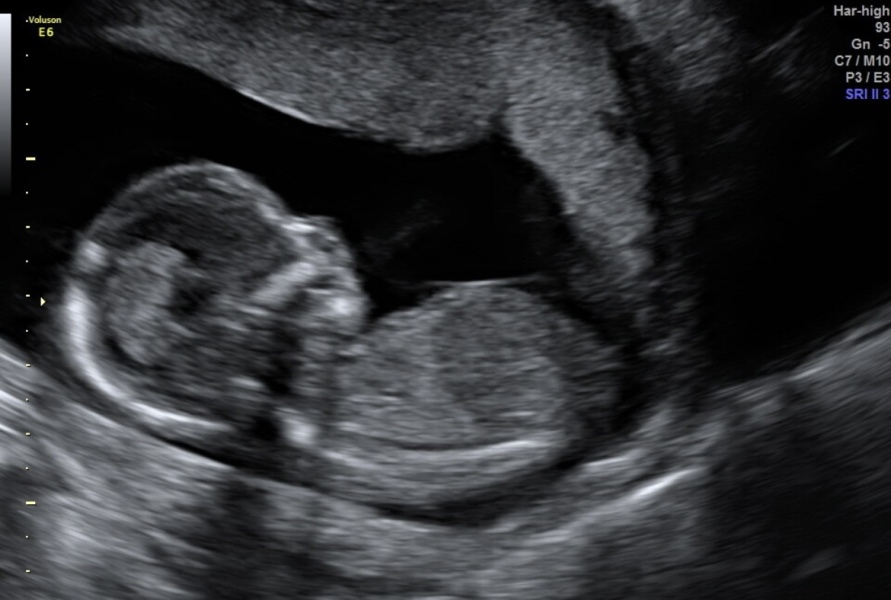 Boy or Girl? 👶🏼