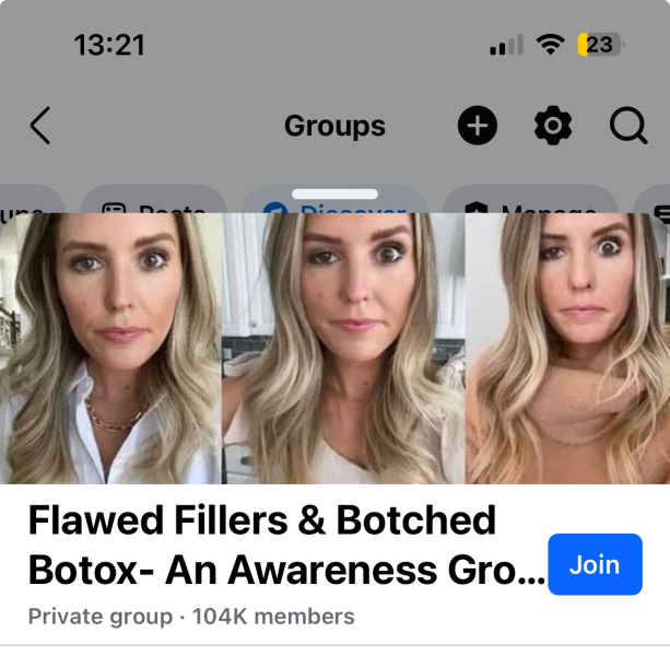 Deep forehead wrinkles