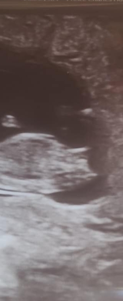 Gender guesses please