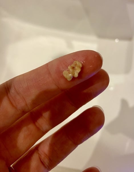 Soo grossed out but kind of proud