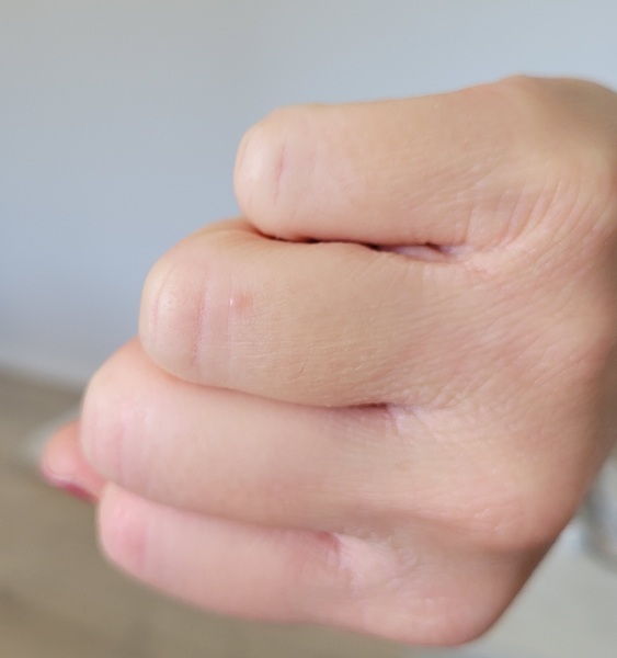 Any idea what this is on my finger?