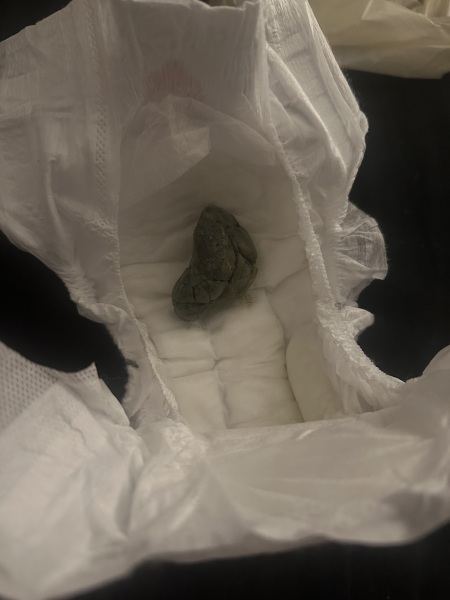 *POOP PICTURE* is this normal?