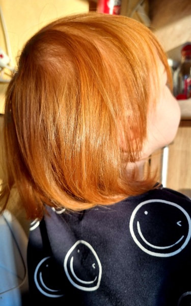 To worry that my red haired child will grow up with a complex