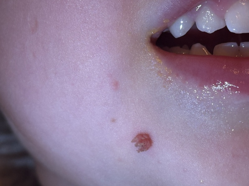 What is this on my daughters face