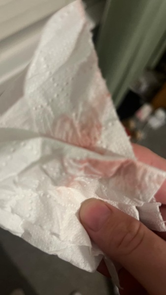 Am I having a miscarriage or is this spotting?