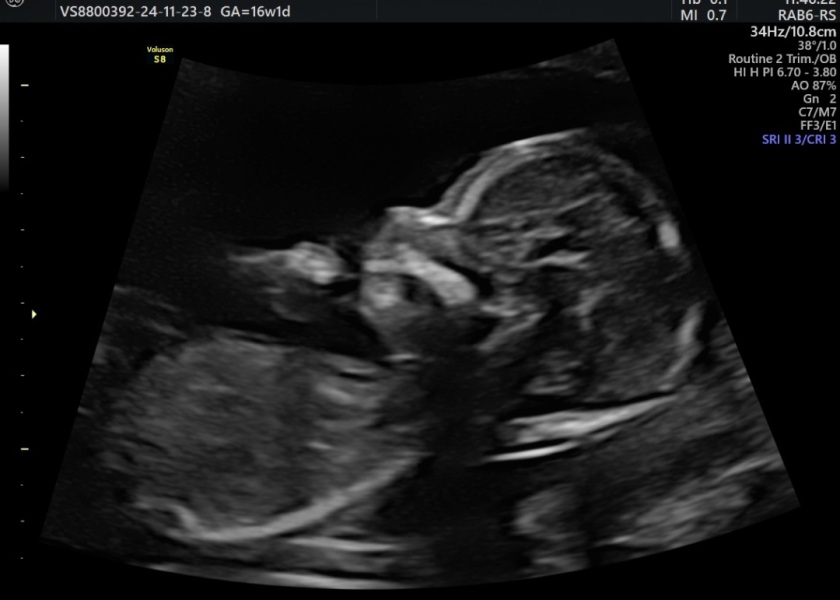 May Babies 2025 - Thread 2