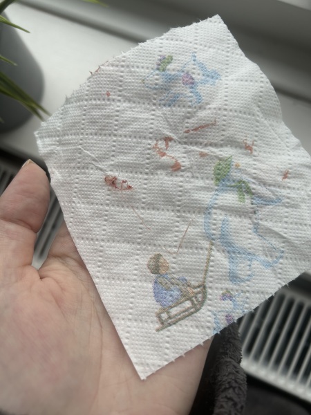 6 week post c section stitches came out with period???!