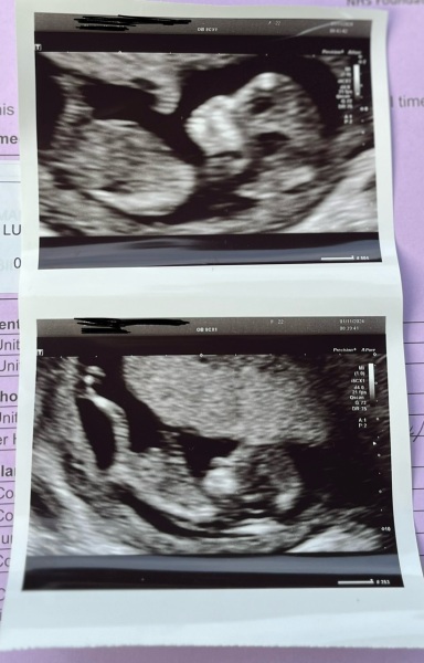 My first can does it look like a girl or boy