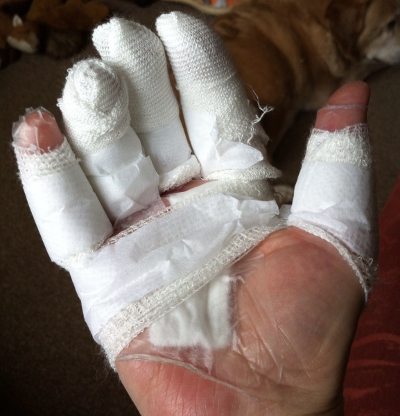 Had a nasty reaction to deep heat, not sure if I need to go to a&e or GP’s