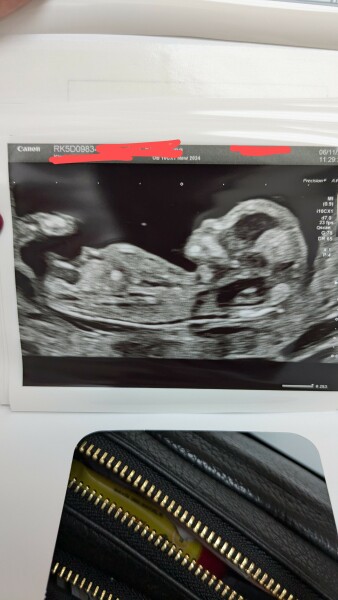 Nub theory? 13 weeks