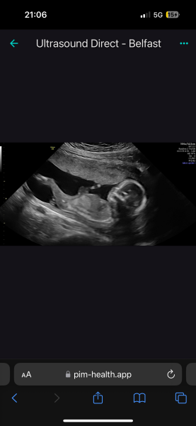 Gender Guesses Please