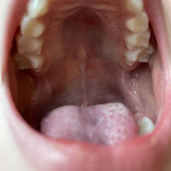No paediatric rheumatologists in our health board 😫