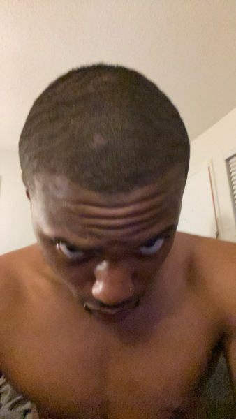 Bald spots on my head