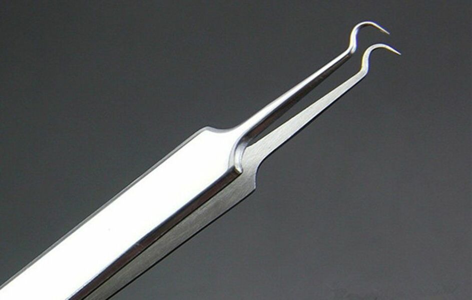 Deep blackhead on DS's forehead. Ideas for removal