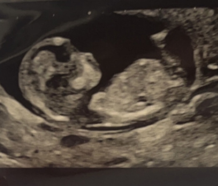 A little bit of fun "boy or girl"