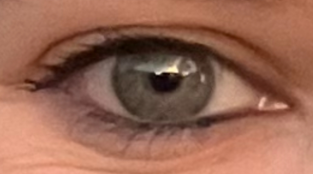 What colour are these eyes?