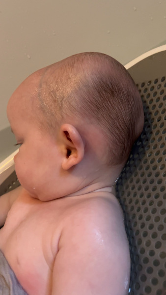 4 month old head shape