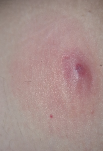 Is this a bite ?