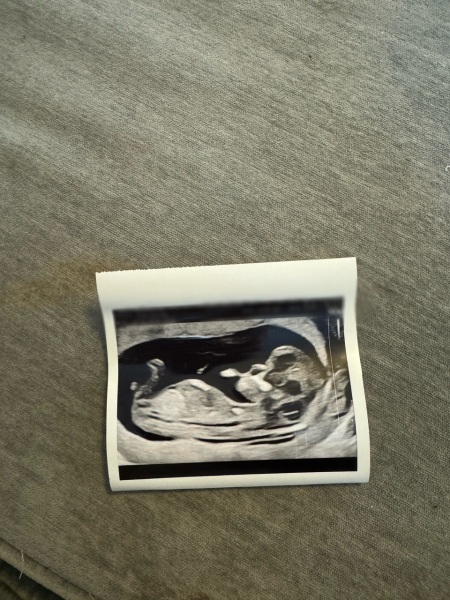Boy or girl? Nun theory