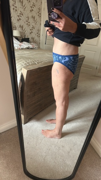 Anyone else lost their bottom? Pic attached - be warned!