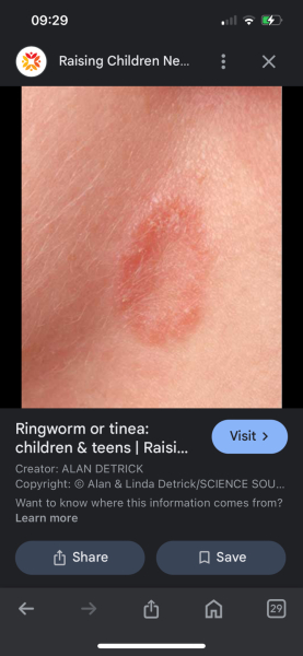 Any idea what this might be on DS' leg?