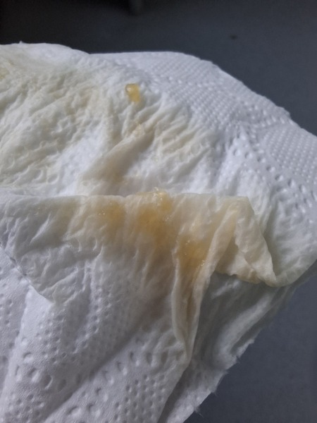(TW photo) Jelly in pee?