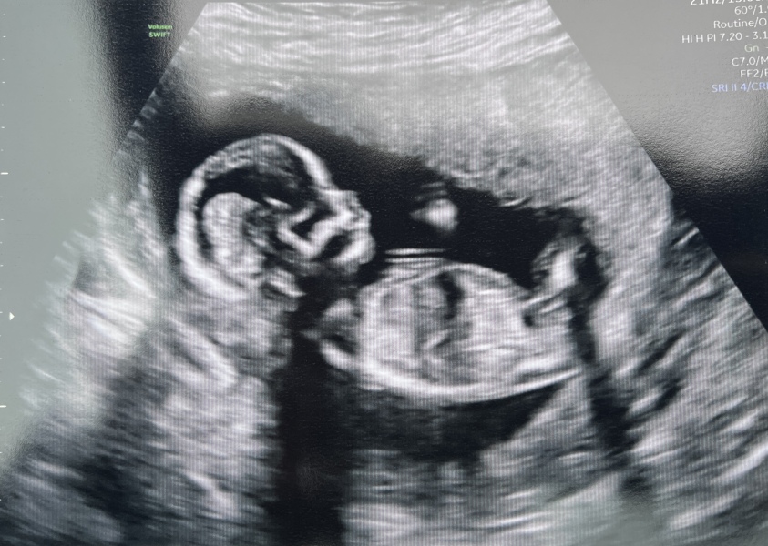 Due April 2025 ✨