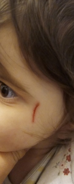 Have I overreacted ? - Nursery