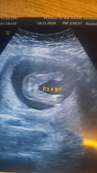 16 week scan, is this definetly a girl?!
