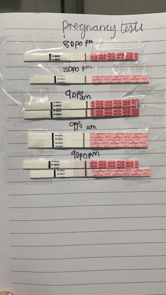 Does anyone see anything on these tests